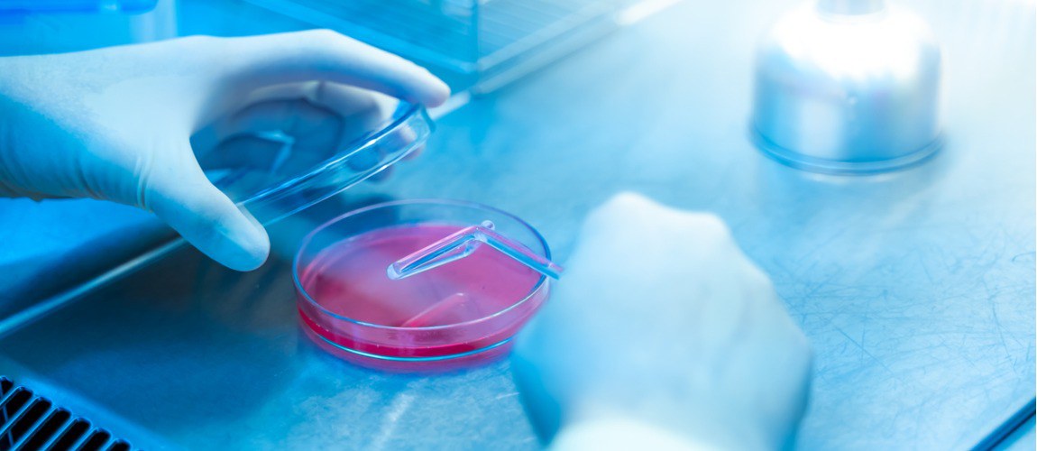 Considerado um dos maiores desafios para a saúde pública, a resistência de microrganismos aos antimicrobianos é um tema de grande preocupação entre os principais fóruns internacionais. Saiba mais!