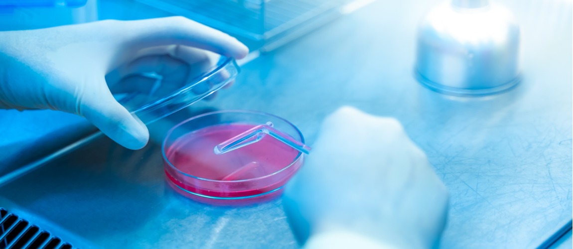 Resistência aos antimicrobianos