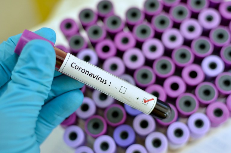 teste coronavirus.jpg