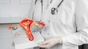 endometriose.jpg