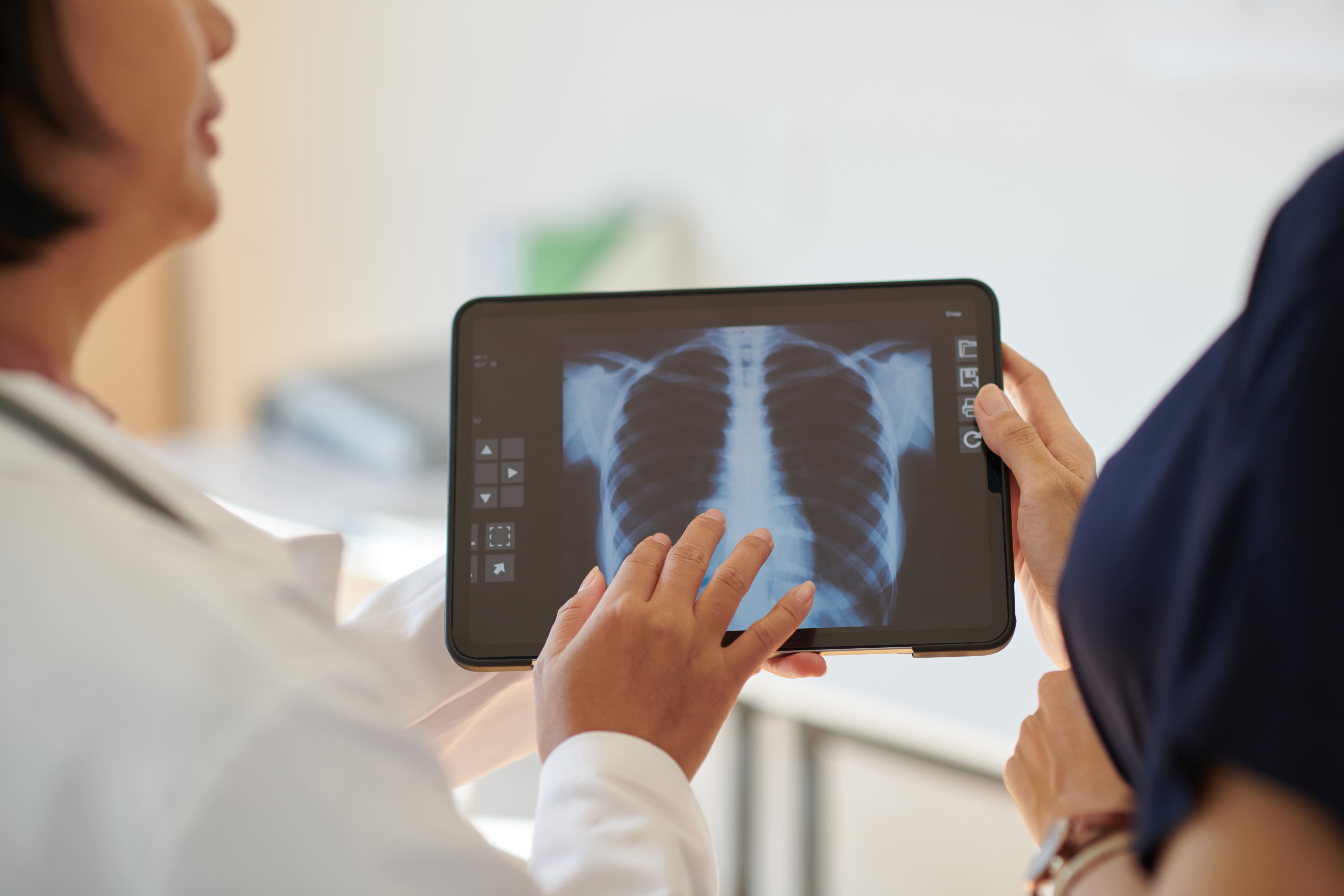 Anvisa aprova medicamento para hipertensão pulmonar