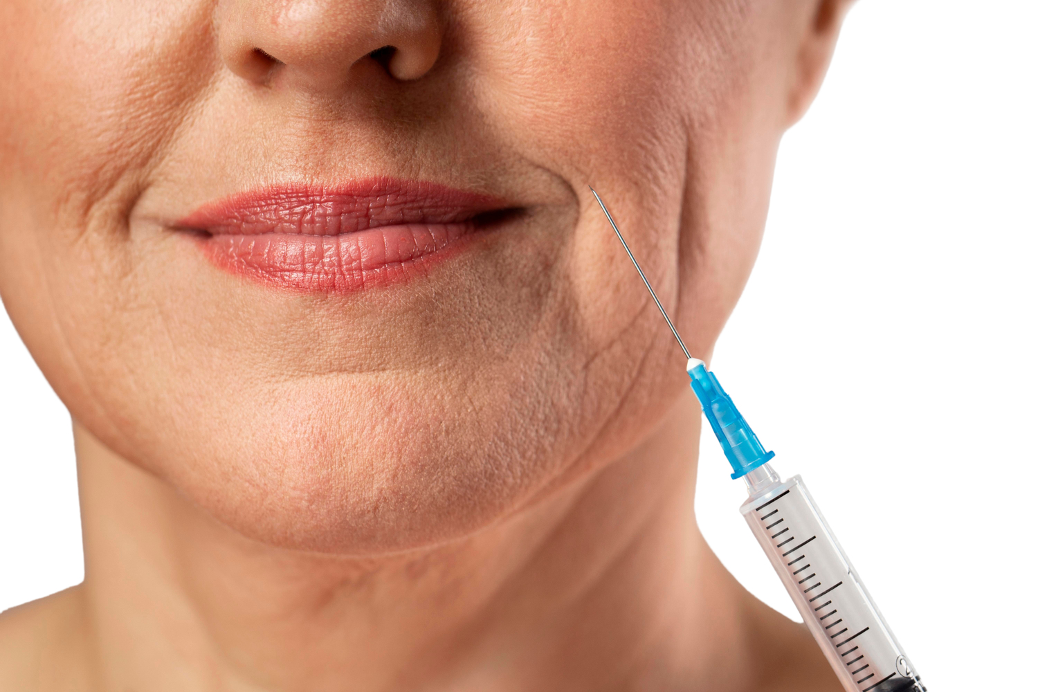 Anvisa recomenda: preenchedores dérmicos somente dentro das indicações aprovadas