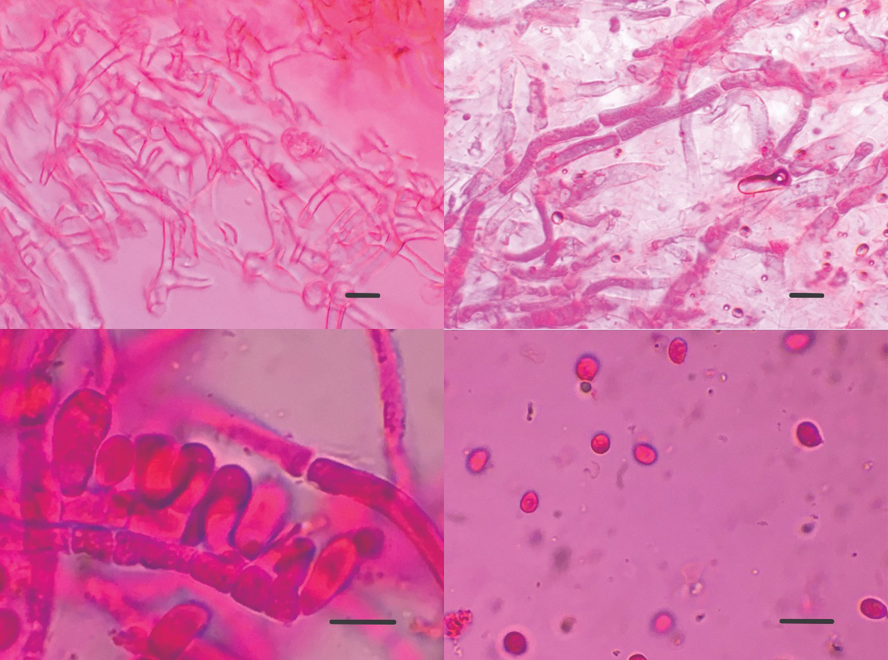 080720520 FOTO DENTRO MATERIA BOLSISTA DESTAQUE FORMIGAS