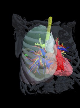 Imagem 3D do pulmão (Foto: Arquivo pessoal)
