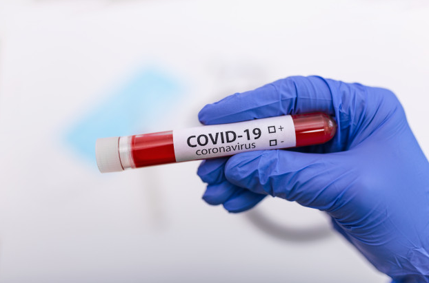 Covid 19 Aprovada A Realizacao De Testes Rapidos Em Farmacias Portugues Brasil