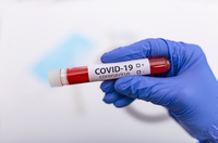 Covid-19: aprovada a realização de testes rápidos em farmácias