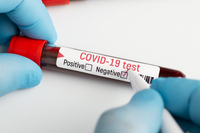 Covid-19: mais de 100 mil brasileiros estão recuperados