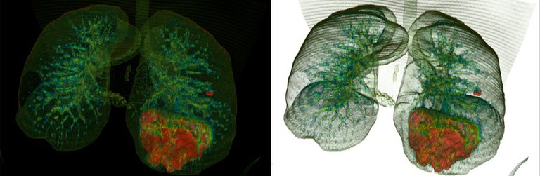 inteligência artificial (IA) e imagens 3D