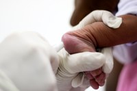 O Teste do Pezinho agora também será utilizado para detectar a toxoplasmose congênita