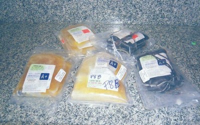 Irradiação de Hemoderivados para inviabilização de doença GVHD