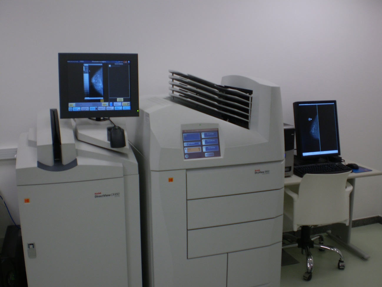Sistema Digitais de Imagens Mamográfica  