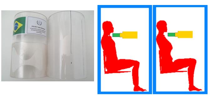 Modelo Físico de Tireoide e Modelo Computacional para simulação via Metodo de Monte Carlo