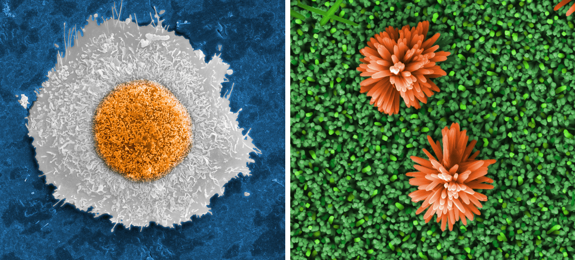 Micrografistas de todo o país vão contar os dias de 2026 observando imagens produzidas por profissionais do Cetene.