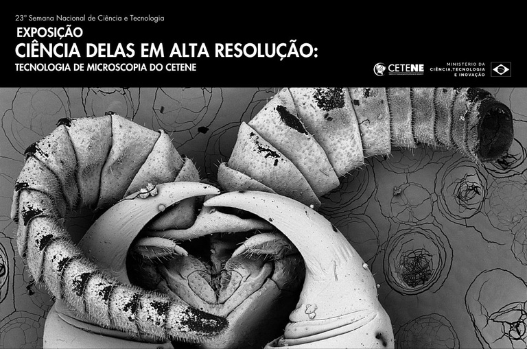 Imagem de microscopia eletrónica em preto e branco em alta resolução com o título do evento "Exposição Ciência Delas em Alta Resolução" e logotipos institucionais do CETENE e do Governo Federal.