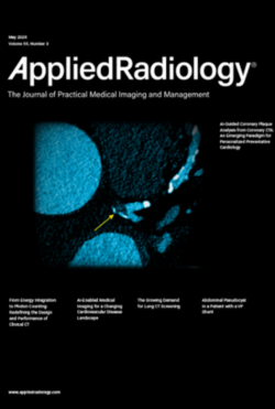Revista 1