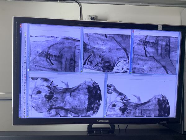 Imagens de raio x. Foto: Pablo Vásquez