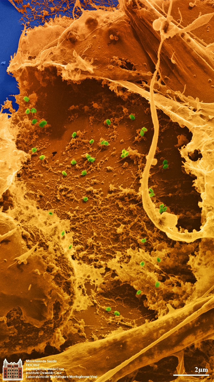 MPOX VIRUS