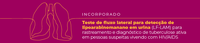 Conitec recomenda incorporação de teste para rastreamento e diagnóstico de tuberculose ativa em pessoas vivendo com HIV/AIDS