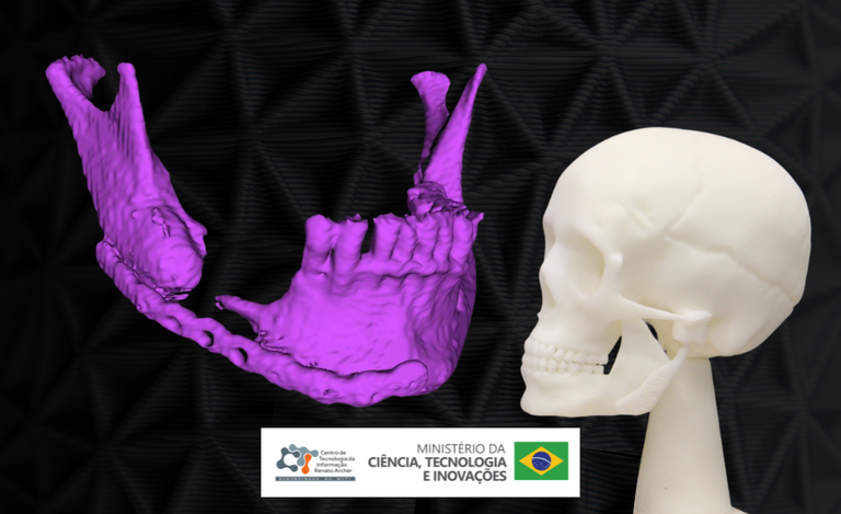 CTI e UFABC iniciam o desenvolvimento de novos materiais para impressão 3D de próteses buco-maxilo-faciais