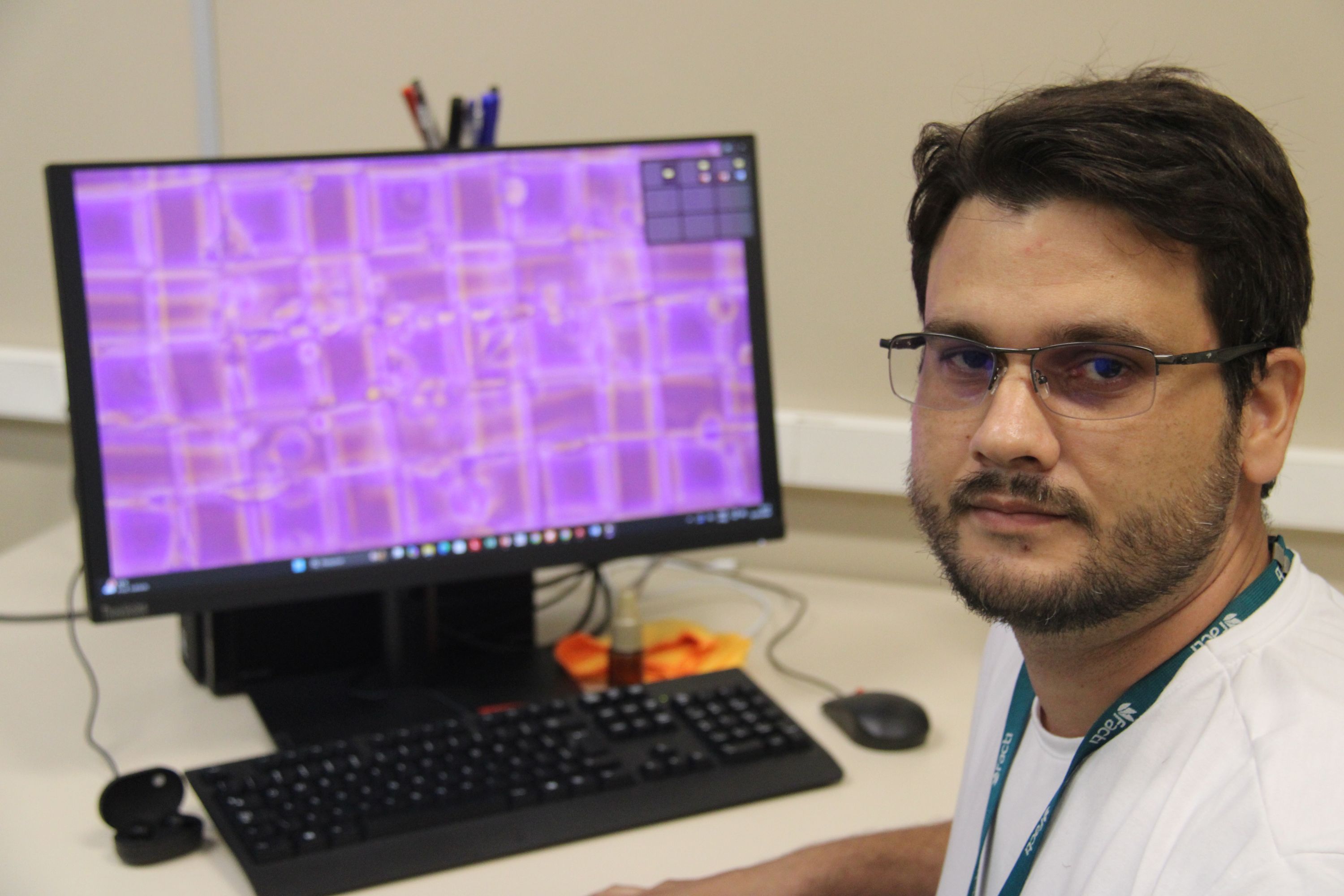 Impressão 3D micrométrica com células vivas é avanço inédito na área de biomateriais