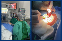 HC adquire moderno equipamento para realização de cirurgias de catarata e de retina