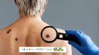 HUJM-Ufmt realiza atendimento especial à população para investigação do câncer de pele