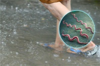 Mesmo com redução de casos, leptospirose exige vigilância durante o período chuvoso