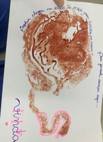 Prints de placenta eternizam conexão entre mãe e bebê no HC-UFTM