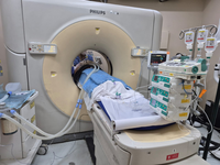 Procedimento de ablação por radiofrequência é utilizado para o tratamento de tumores malignos em pacientes do Huap-UFF