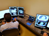 Radiologia do Hucam recebe equipamentos que melhoram exames de imagem