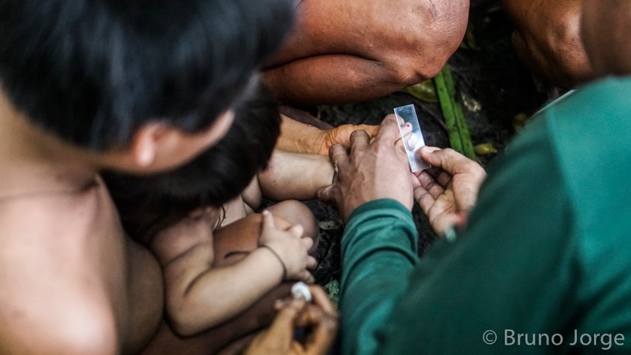 Exame em crianca korubo