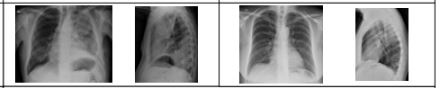 HCPA