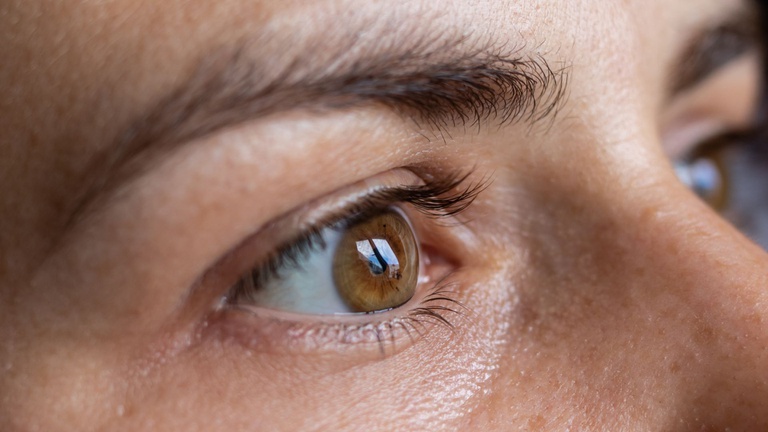 08112024 ebserh ceratocone