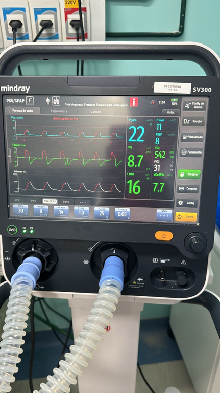 23052024 alarmes sonoros ebserh 4.png