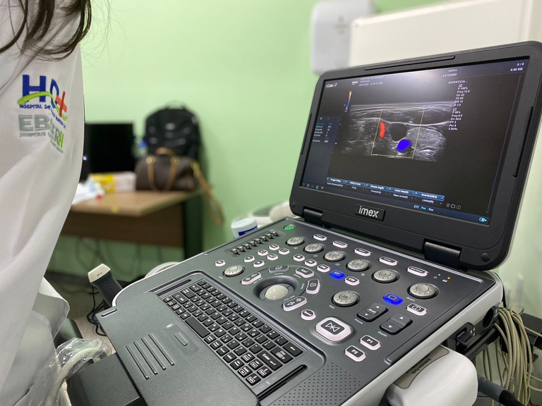 01032023 equipamento hdt-uft (1).jpeg