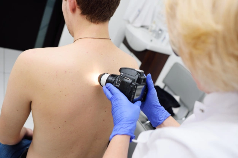 22122021 cancer de pele.png