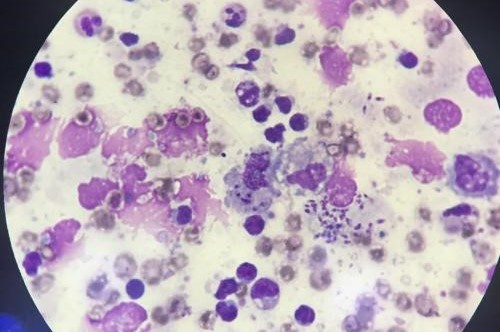 18022020 parasita hu-ufsc.jpg