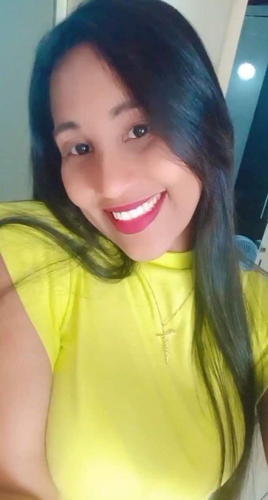 Farmacêutica Vanessa Silva, primeira paciente da cirurgia de correção de anosmia pós-covid no HU-UFS-Ebserh. Foto - arquivo pessoal..png