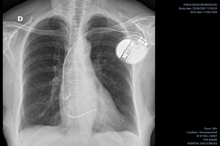 29062021 raio x hc-ufmg 4.png