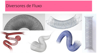 Imagem dos diversores de fluxo ou stents utilizados no procedimento