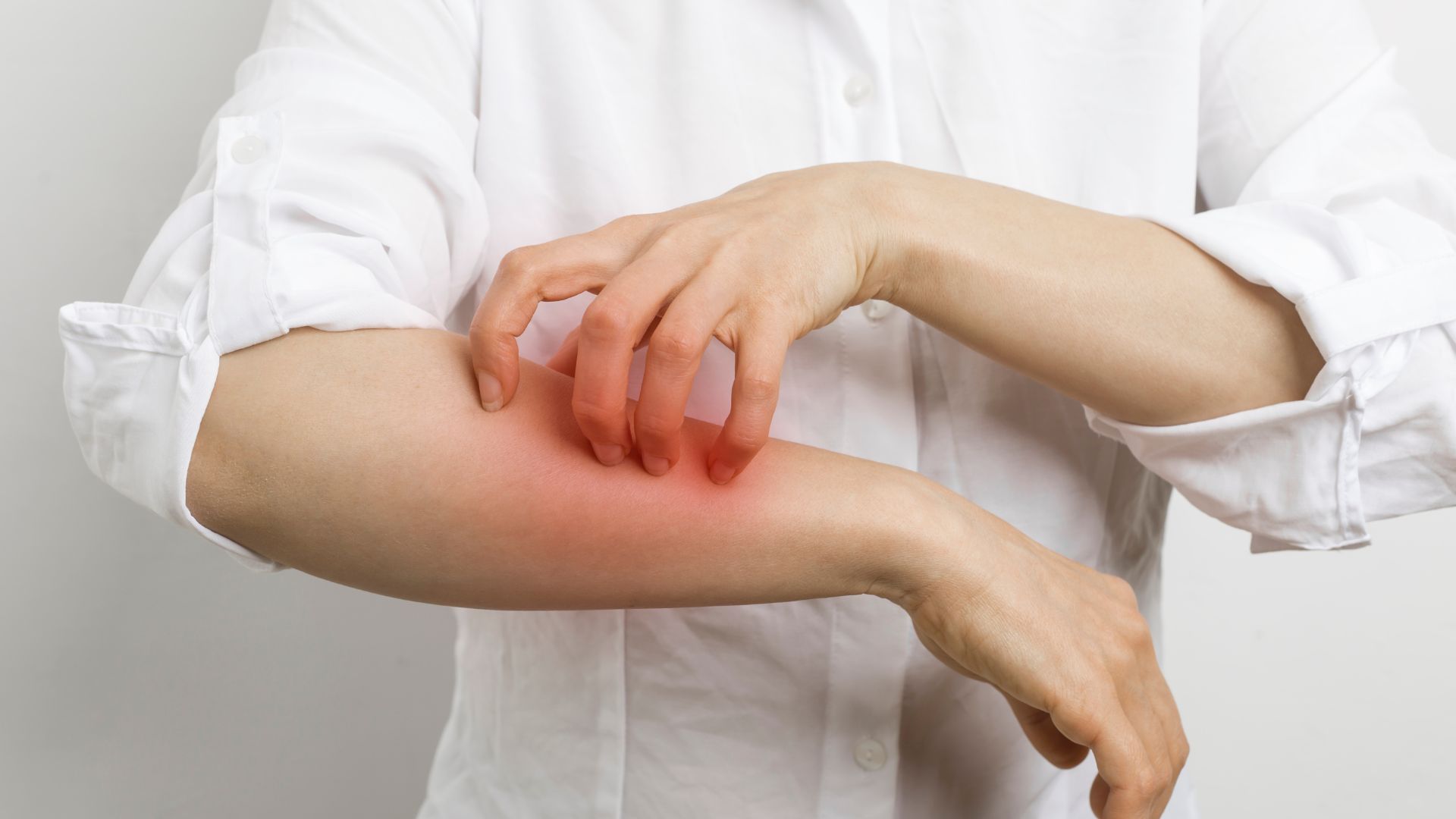 Dermatites podem ser causadas por exposição a pelos de animais ou a determinados produtos