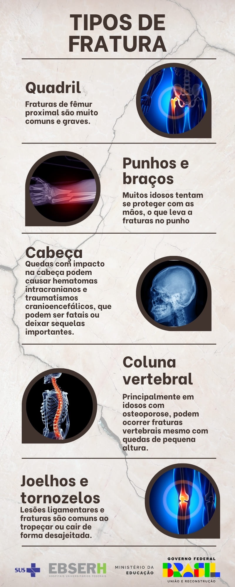 24062025 ebserh dia mundial prevenção quedas idoso infográfico