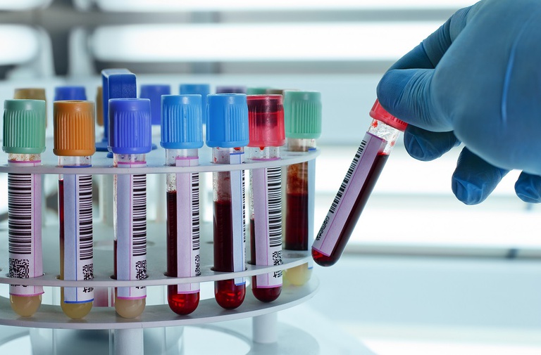 19112019-diagnostico-sifilis-hc-uftm.jpg