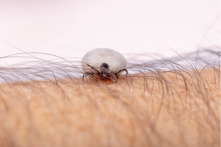 04082025 ebserh doença lyne