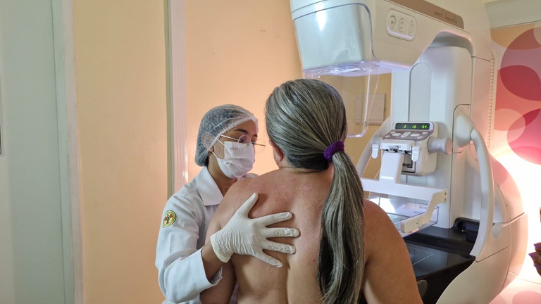 13122025 Ebserh e ministérios da Educação e da Saúde realizam o maior mutirão da história do SUS  (17).jpeg