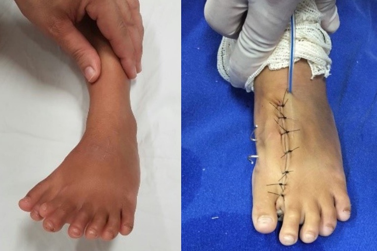 05072022 Equipe do HC-UFG realiza cirurgia para correção.jpg