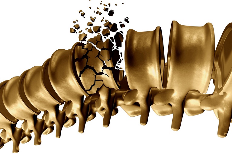 29102021 osteoporose.jpg