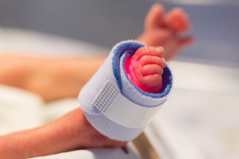 17112021 prematuridade.jpg