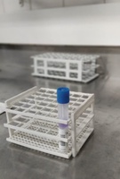 Estudo do Ministério da Saúde sobre exame genético de alta complexidade tem participação do Complexo da Rede HU Brasil no Rio de Janeiro (RJ)