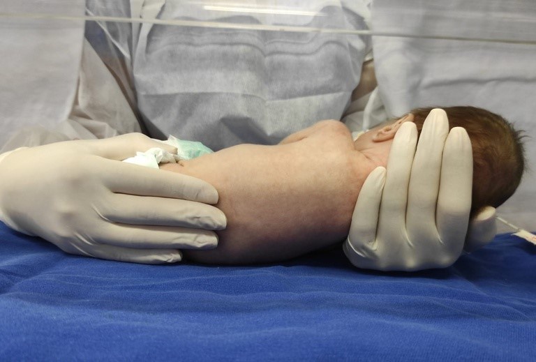 25092025 ebserh humap-ufms pesquisa fisioterapia neonatal 1.jpeg